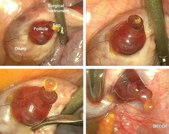 ���ѹ���ʵ��ͼ