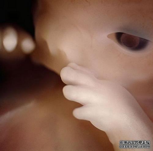 10周大的胎儿 10周大的胎儿