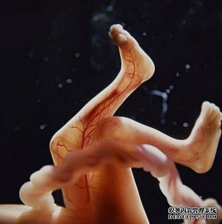 血管透过皮肤清晰可见。 血管透过皮肤清晰可见。