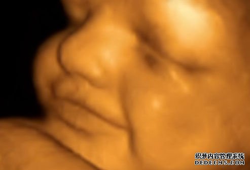6个月三维彩超 6个月三维彩超