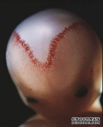 9�ܺ� V��Ѫ����ͷ���ڻ㴦����