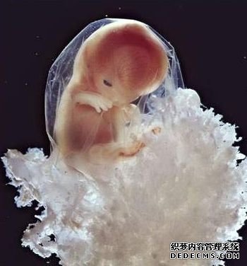 20�ܺ� ̥�����ڳ�Լ20����