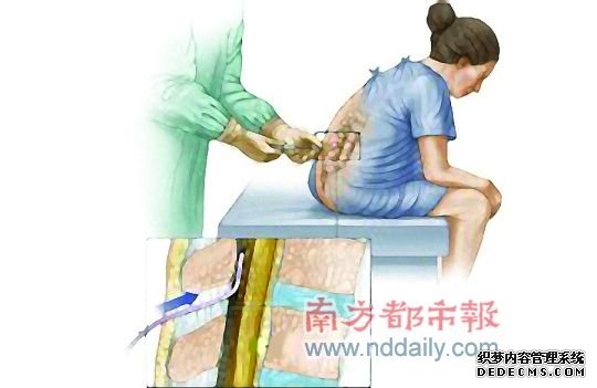 1.���뵼�� ӲĤ��ǻ ����