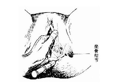 1 1