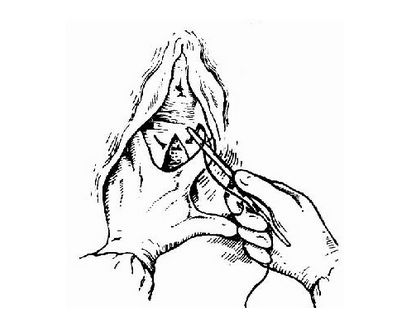 3 3