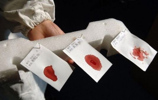 ������Ա���ڶԸոճ�ȡ��һ�����ڵ�Ѫ�����д���