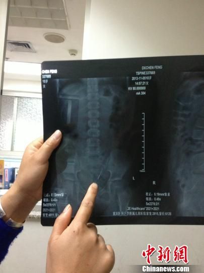 ҽ�������ָ���廨���ڷ�����ڵ�λ�á� ����ѩ�� ��