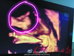 林志颖曝光产检4D照 林志颖曝光产检4D照