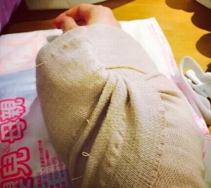 范玮琪晒“网球肘” 范玮琪晒“网球肘”