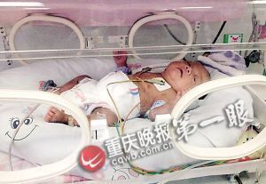 刚出生不久在儿童医院接受治疗的张文浩 刚出生不久在儿童医院接受治疗的张文浩