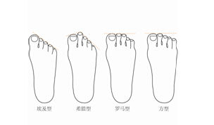 图2-1 常见的四种脚型 图2-1 常见的四种脚型