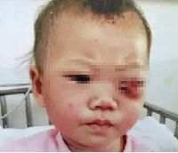 被戳眼的孩子 被戳眼的孩子