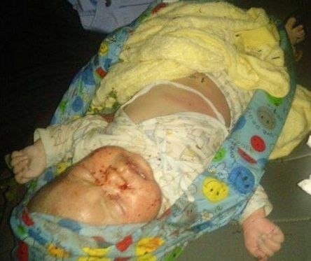 男婴被爸遗弃脸上爬满蚂蚁 男婴被爸遗弃脸上爬满蚂蚁