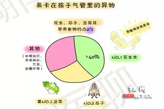 (易卡在孩子气管里的异物种类。) (易卡在孩子气管里的异物种类。)
