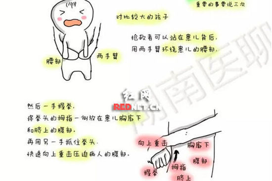(对年龄比较大的孩子如果有异物卡住家长应该知道的应急处理方法。) (对年龄比较大的孩子如果有异物卡住家长应该知道的应急处理方法。)